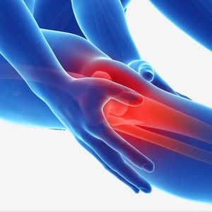Image of joint pain