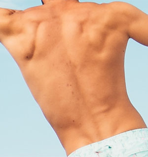 Picture of a mans back muscles
