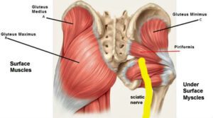 Diagram of piriformus muscle and other buttoks / glute muscles with the sciatic nerve
